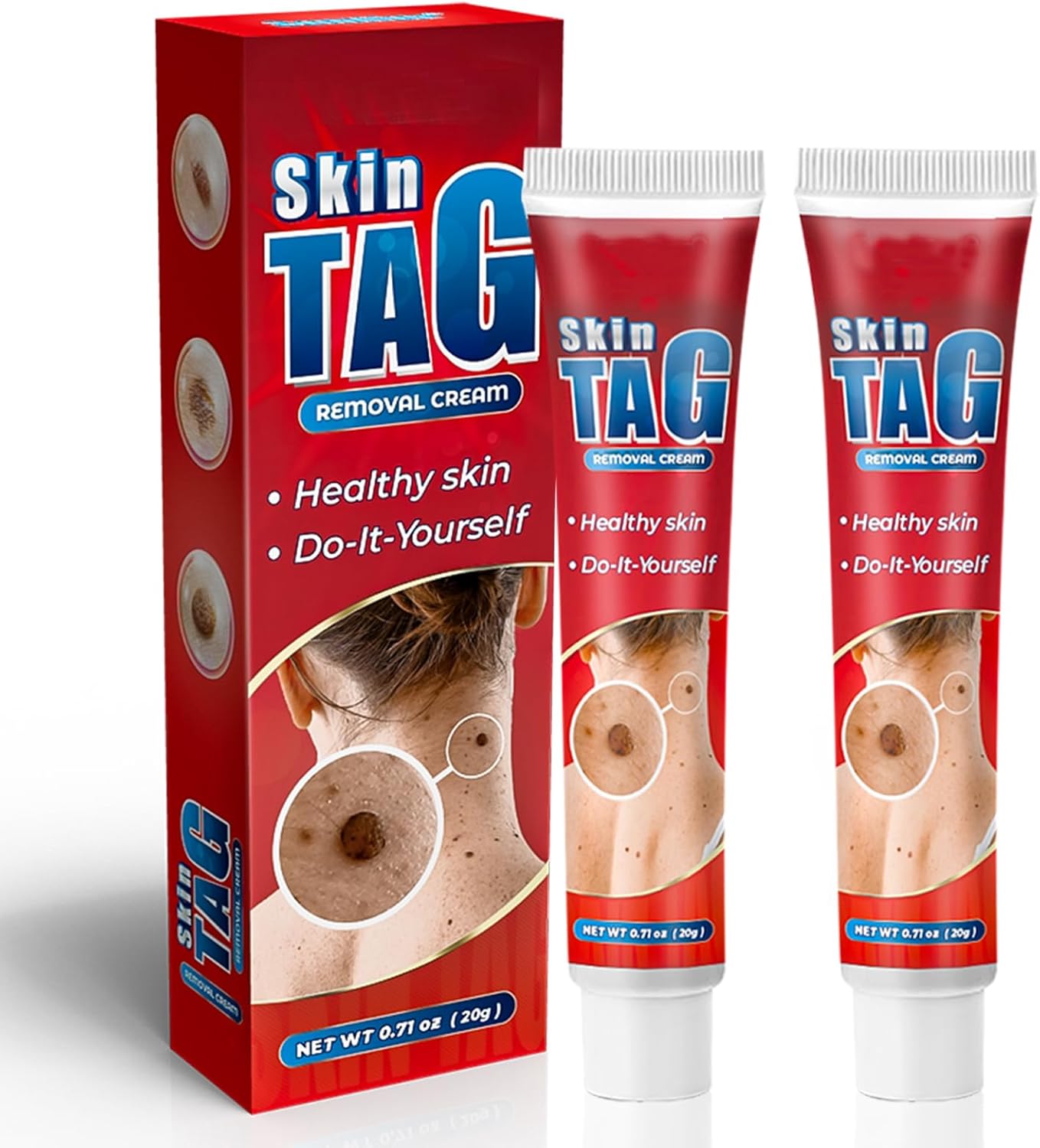 skin tag remover